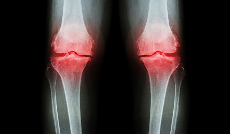 Лучшие 3 пользы для здоровья льняного семени